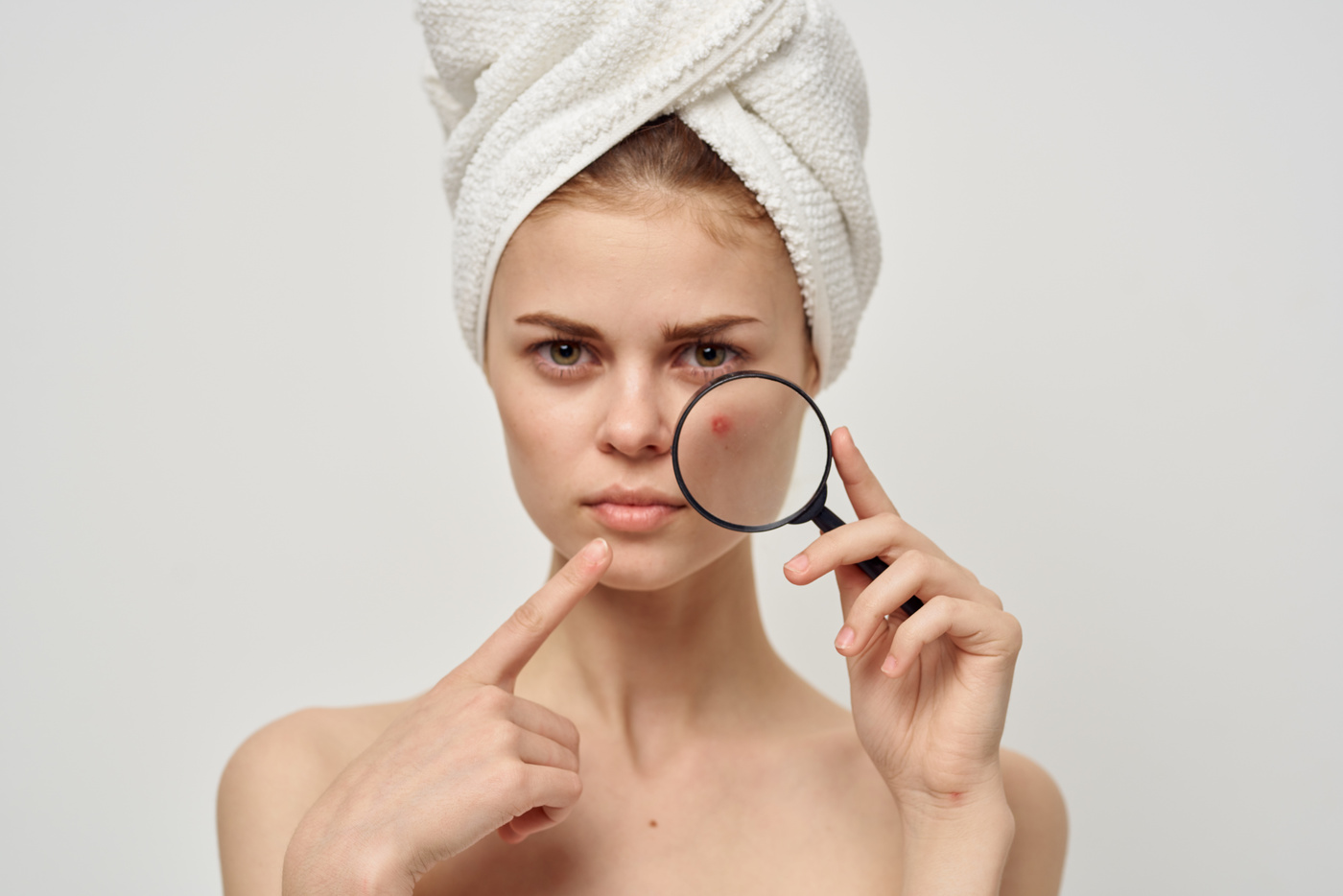 Pretty Woman with Magnifying Glass near Face Acne Acne Skin Care Appearance